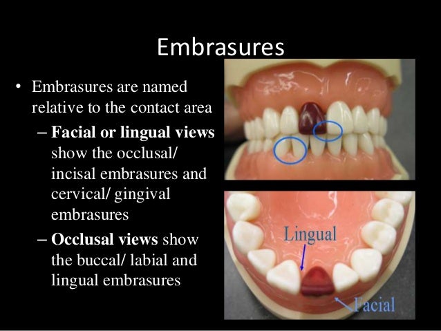 dental anatomy physiology of permanent teeth 15 638