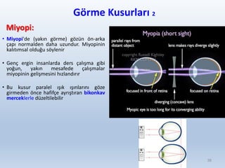 Görme Kusurları 2
Miyopi:
• Miyopi'de (yakın görme) gözün ön-arka
çapı normalden daha uzundur. Miyopinin
kalıtımsal olduğu söylenir
• Genç ergin insanlarda ders çalışma gibi
yoğun, yakın mesafede çalışmalar
miyopinin gelişmesini hızlandırır
• Bu kusur paralel ışık ışınlarını göze
girmeden önce hafifçe ayrıştıran bikonkav
merceklerle düzeltilebilir
38
 