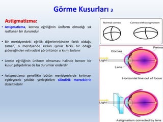 Görme Kusurları 3
Astigmatizma:
• Astigmatizma, kornea eğriliğinin üniform olmadığı sık
rastlanan bir durumdur
• Bir meridyendeki eğrilik diğerlerinkinden farklı olduğu
zaman, o meridyende kırılan ışınlar farklı bir odağa
gideceğinden retinadaki görüntünün o kısmı bulanır
• Lensin eğriliğinin üniform olmaması halinde benzer bir
kusur gelişebilirse de bu durumlar enderdir
• Astigmatizma genellikle bütün meridyenlerde kırılmayı
eşitleyecek şekilde yerleştirilen silindirik merceklerle
düzeltilebilir
39
 
