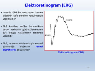 Elektroretinogram (ERG)
• İnsanda ERG bir elektrodun kornea
diğerinin kafa derisine konulmasıyla
yazdırılabilir
• ERG kayıtları, oküler bulanıklıktan
dolayı retinanın görüntülenmesinin
güç olduğu hastalıkların tanısında
yararlıdır
• ERG, retinanın oftalmoskopla normal
göründüğü doğmalık retinal
distrofilerde de yararlıdır
60
Elektroretinogram (ERG)
 
