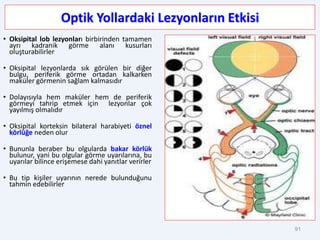 Optik Yollardaki Lezyonların Etkisi
• Oksipital lob lezyonları birbirinden tamamen
ayrı kadranik görme alanı kusurları
oluşturabilirler
• Oksipital lezyonlarda sık görülen bir diğer
bulgu, periferik görme ortadan kalkarken
maküler görmenin sağlam kalmasıdır
• Dolayısıyla hem maküler hem de periferik
görmeyi tahrip etmek için lezyonlar çok
yayılmış olmalıdır
• Oksipital korteksin bilateral harabiyeti öznel
körlüğe neden olur
• Bununla beraber bu olgularda bakar körlük
bulunur, yani bu olgular görme uyarılarına, bu
uyarılar bilince erişemese dahi yanıtlar verirler
• Bu tip kişiler uyarının nerede bulunduğunu
tahmin edebilirler
91
 