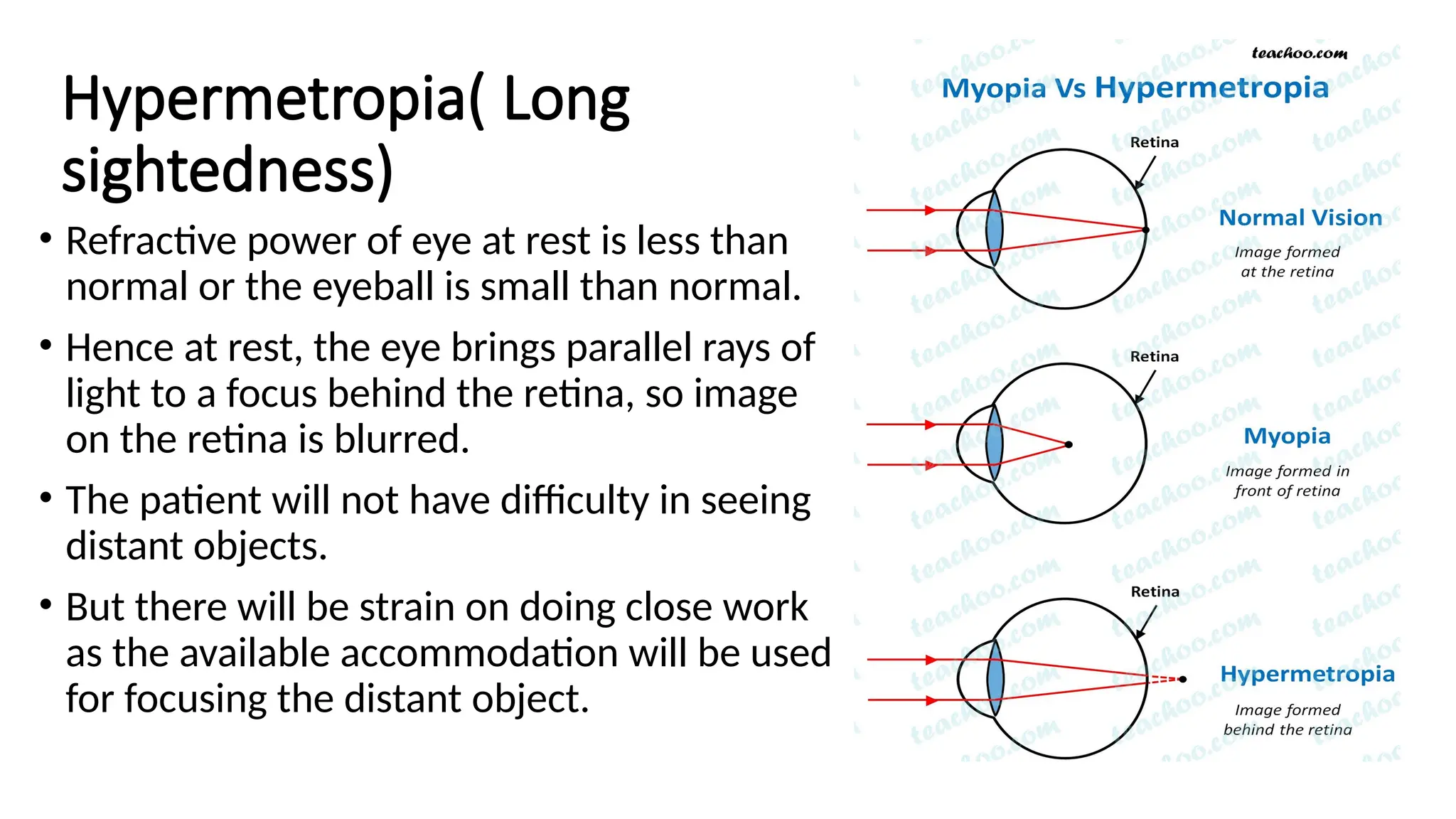 Physiology Of Vision And Vision Pathway pptx