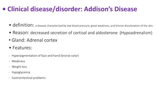 • Clinical disease/disorder: Addison’s Disease
• definition: a disease characterized by low blood pressure, great weakness, and bronze discoloration of the skin.
• Reason: decreased secretion of cortisol and aldosterone (Hypoadrenalism)
• Gland: Adrenal cortex
• Features:
- Hyperpigmentation of face and hand (bronze color)
- Weakness
- Weight loss
- Hypoglycemia
- Gastrointestinal problems
 