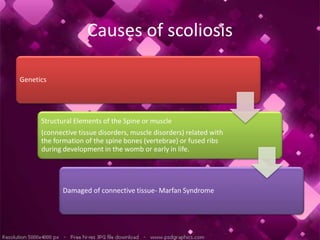 Causes of scoliosis
Genetics
Structural Elements of the Spine or muscle
(connective tissue disorders, muscle disorders) related with
the formation of the spine bones (vertebrae) or fused ribs
during development in the womb or early in life.
Damaged of connective tissue- Marfan Syndrome
 