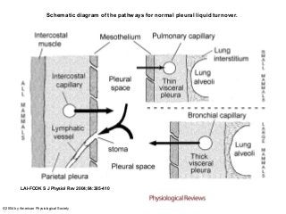 Schematic diagram of the pathways for normal pleural liquid turnover.




          LAI-FOOK S J Physiol Rev 2004;84:385-410



©2004 by American Physiological Society
 