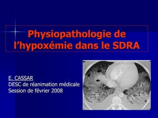 Physiopathologie de
l’hypoxémie dans le SDRA
E. CASSAR
DESC de réanimation médicale
Session de février 2008
 