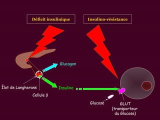 Glucagon
Insuline
Cellule β
Glucose GLUT
(transporteur
du Glucose)
Déficit insulinique Insulino-résistance
Îlot de Langherans
GlucagonGlucagon
 