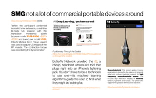 SMG notalotof commercialportabledevicesaround
https://doi.org/10.1002/jum.14995(2019):
“When the participant performed
isometric knee extension, a real-time
B-mode US scanner with the
transducer mentioned above
(scanner model EUB-8500 ~$800-
$7,000 and transducer model L53L;
Hitachi Medical Corp, Tokyo, Japan)
was used to acquire US images of the
RF muscle. The contraction torque
wasrecordedbythe dynamometer.”
PupillometryThroughthe Eyelids
https://www.slideshare.net/PetteriTeikariPhD/pupillomet
ry-through-the-eyelids
Butterfly Network unveiled the iQ, a
cheap, handheld ultrasound tool that
plugs right into an iPhone’s lightning
jack. You don’t have to be a technician
to use one—its machine learning
algorithms guide the user to find what
theymight be lookingfor.
https://www.wired.com/story/artificial-intelligence-is-putting-ultrasound-on-y
our-phone/
Musculoskeletal This preset applies imaging
parameters to display the fine balance of temporal,
detail and contrast resolution required for high
frequency musculoskeletal exams. This
includes high resolution imaging of muscles,
tendons, ligaments and bursae. The preset also
supportstheguidanceof therapeutic injections.
https://www.butterflynetwork.com/specs
 