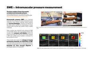 SWEfor Intramuscularpressuremeasurement
Theshearmodulusoflower-legmuscles
correlatestointramuscularpressure
Seyedali Sadeghi, MatthewJohnson, Dov A.Bader,Daniel H.Cortes
JournalofBiomechanicsVolume83,23January2019
https://doi.org/10.1016/j.jbiomech.2018.11.045
Intramuscular pressure (IMP) is an important
parameter that changes with passive and active muscle
contraction, body position, exercise, blood pressure,
and several pathologies. Therefore, the objective of
this study was to quantify the dependency of shear
modulus within the lower-leg muscles on IMP in healthy
individuals.
Shear modulus was measured using ultrasound SWE
on the tibialis anterior (TA) and peroneus longus (PL)
muscles using pressure cuff inflation around the
thigh at 40mmHg, 80mmHg, and 120mmHg. Changes
in IMP were verified using a catheter connected to a
bloodpressuremonitor.
These results demonstrate that changes of muscle
mechanical properties are dependent on IMP.
This observation is important to improve interpretation
of ultrasound elastograms and to potentially use it as a
biomarker for more accurate diagnosis of
pathologiesrelatedtoincreasedIMP.
 