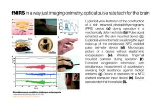 fNIRS inaway justimagingoximetry, opticalpulse rate techforthe brain
Wearablesensors:modalities,challenges,and prospects
Heikenfeldetal. LabChip, 2018,18,217-248
https://doi.org/10.1039/C7LC00914C
Exploded-view illustration of the construction
of a skin mounted photoplethysmography
(PPG) device (a) during operation in a
mechanically deformed state (b). Pulse signal
extracted with the skin mounted device (c).
Exploded-view schematicvisualizingthelayer
make-up of the miniaturized NFC enabled
pulse oximeter device (d). Microscopic
picture of a device without elastomeric
encapsulation (e). Wireless fingernail
mounted oximeter during operation (f).
Extracted oxygenation information with
simultaneous measurement of acceleration,
revealing high resistance against motion
artefacts. (g) Device in operation on a NFC
enabled computer input device (h). Device
operationbehindthe earlobe (i).
 
