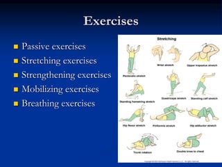 Exercises
 Passive exercises
 Stretching exercises
 Strengthening exercises
 Mobilizing exercises
 Breathing exercises
 