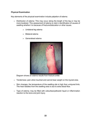 Physical Examination
Key elements of the physical examination include palpation of edema:
o Distribution of edema: This may occur along the length of the leg or may be
more localized. This assessment of edema is vital in identification of causes of
swelling whether it is because of fracture/dislocation or other issues.
 Unilateral leg edema
 Bilateral edema
 Generalised edema
Diagram shows an edema results from fracture ankle
o Tenderness- pain when touched and cannot bear weight on the injured area.
o Skin changes; the temperature of the swelling site is high than uninjured limb.
The heat radiates from the swelling area is due to extra blood flow.
o Type of edema; may be filled with colourless/yellowish liquid or inflammation
reaction to the bone and joint injury.
22
 