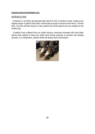 WHEELCHAIR FOR BROKEN LEG
INTRODUCTION
A fracture or a broken leg typically take about 8 until 12 weeks to heal, maybe even
slightly longer if patient have been unfortunate enough to fracture their femur. Till that
time, not only will their leg be in cast, patient will not be able to put any weight on the
broken leg.
If patient have suffered from an ankle fracture, physician therapist will most likely
advice their patient to keep the ankle bone facing upwards to quicken the healing
process. In a wheelchair, patient ankle will always face downwards.
47
 