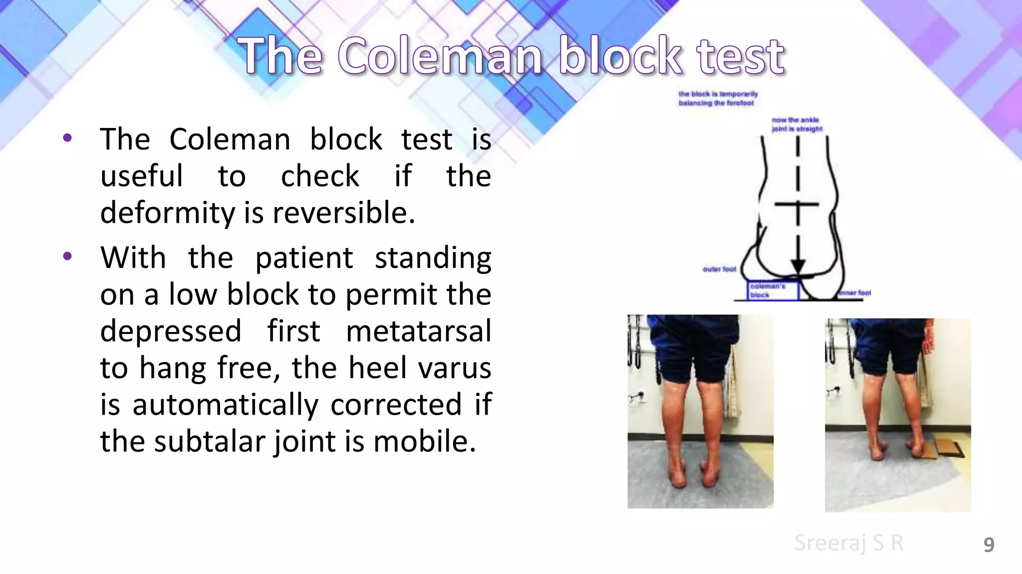 Physiotherapy for ankle & foot deformities | PPTX
