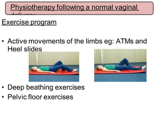 Exercise program
• Active movements of the limbs eg: ATMs and
Heel slides
• Deep beathing exercises
• Pelvic floor exercises
Physiotherapy following a normal vaginal
delivery
 
