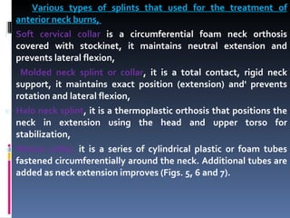 Various types of splints that used for the treatment of anterior neck burns,  Soft cervical collar  is a circumferential foam neck orthosis covered with stockinet, it maintains neutral extension and prevents lateral flexion,  Molded neck splint or collar , it is a total contact, rigid neck support, it maintains exact position (extension) and' prevents rotation and lateral flexion,  Halo neck splint , it is a thermoplastic orthosis that positions the neck in extension using the head and upper torso for stabilization,  Watusi collar,  it is a series of cylindrical plastic or foam tubes fastened circumferentially around the neck. Additional tubes are added as neck extension improves (Figs. 5, 6 and 7). 