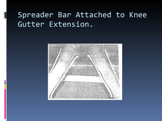 Spreader Bar Attached to Knee Gutter Extension. 