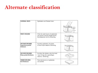 Alternate classification
 