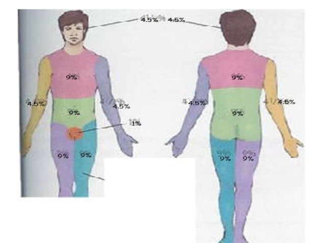 Physiotherapy in burns | PPT | Physical Therapy | Wellness