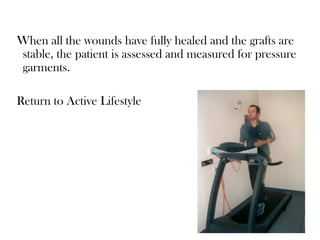 When all the wounds have fully healed and the grafts are
stable, the patient is assessed and measured for pressure
garments.
Return to Active Lifestyle
 