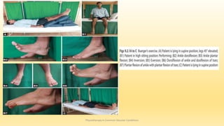 Physiotherapy in Common Vascular Conditions
 