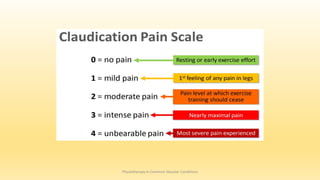 Physiotherapy in Common Vascular Conditions
 