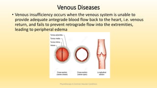 Venous Diseases
• Venous insufficiency occurs when the venous system is unable to
provide adequate antegrade blood flow back to the heart, i.e. venous
return, and fails to prevent retrograde flow into the extremities,
leading to peripheral edema
Physiotherapy in Common Vascular Conditions
 