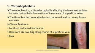 1. Thrombophlebitis
Thrombophlebitis, a disorder typically affecting the lower extremities
is characterized by inflammation of inner walls of superficial veins
The thrombus becomes attached on the vessel wall but rarely forms
embolus
Clinical Features-
• Localised reddened warm area
• Hard cord like swelling along course of superficial vein
• Pain
Physiotherapy in Common Vascular Conditions
 