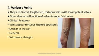 4. Varicose Veins
They are dilated, lengthened, tortuous veins with incompetent valves
Occur due to malfunction of valves in superficial veins
Clinical Features-
• Veins appear tortuous knotted structures
• Cramps in the calf
• Oedema
• Skin colour changes
Physiotherapy in Common Vascular Conditions
 