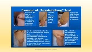 Physiotherapy in Common Vascular Conditions
 