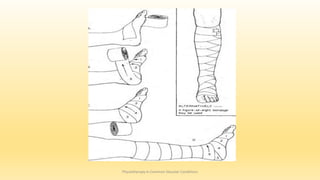 Physiotherapy in Common Vascular Conditions
 