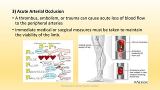 3) Acute Arterial Occlusion
• A thrombus, embolism, or trauma can cause acute loss of blood flow
to the peripheral arteries
• Immediate medical or surgical measures must be taken to maintain
the viability of the limb.
Physiotherapy in Common Vascular Conditions
 