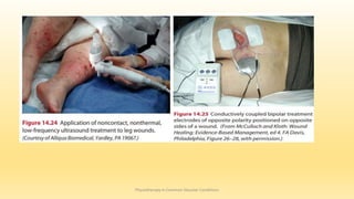 Physiotherapy in Common Vascular Conditions
 