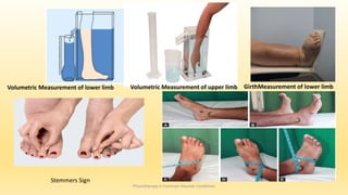 Physiotherapy in Common Vascular Conditions
Volumetric Measurement of lower limb Volumetric Measurement of upper limb GirthMeasurement of lower limb
Stemmers Sign
 