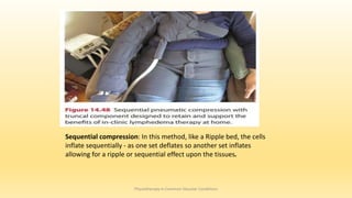 Physiotherapy in Common Vascular Conditions
Sequential compression: In this method, like a Ripple bed, the cells
inflate sequentially - as one set deflates so another set inflates
allowing for a ripple or sequential effect upon the tissues.
 