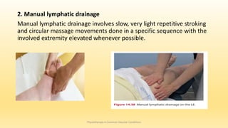 2. Manual lymphatic drainage
Manual lymphatic drainage involves slow, very light repetitive stroking
and circular massage movements done in a specific sequence with the
involved extremity elevated whenever possible.
Physiotherapy in Common Vascular Conditions
 