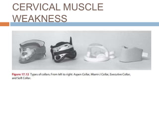 CERVICAL MUSCLE
WEAKNESS
 