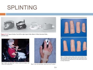 SPLINTING
 