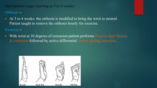 Intermediate stage (starting at 3 to 4 weeks):
Orthosis :-
 At 3 to 4 weeks- the orthosis is modified to bring the wrist to neutral.
Patient taught to remove the orthosis hourly for exercise.
Exercise :-
 With wrist at 10 degrees of extension patient performs Passive digit flexion
& extension followed by active differential tendon gliding exercises.
 