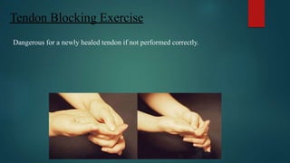 Tendon Blocking Exercise
Dangerous for a newly healed tendon if not performed correctly.
 