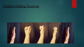 Tendon Gliding Exercise
 