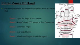 Flexor Zones Of Hand
▶ Flexor tendon injuries have been classified into zones by Verdan
1960.
Zone 1- Tip of the finger to FDS tendon
Zone 2- Noman’s land- FDS tendon to dist. Palm crease
Zone 3 - Lumbrical origin
Zone 4 - over carpal tunnel
Zone 5 - Muscle-tendon junction (Volar aspect)
 