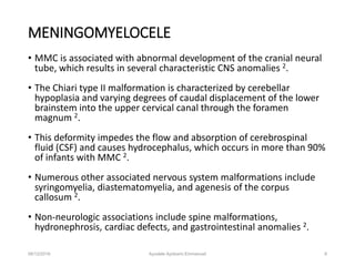 Spina Bifida: Physiotherapy in the management of meningomyelocele | PPTX