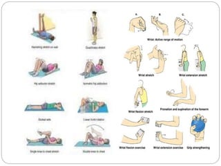 Physiotherapy Management For Rheumatoid Arthritis