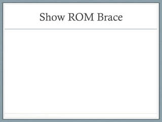 Show ROM Brace 
 
