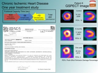 CIRCULAT in Chronic Ischemic Heart Disease - 20 Pat, Diabetic Foot and Gene Expression