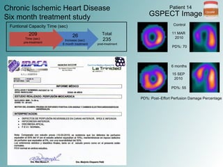 CIRCULAT in Chronic Ischemic Heart Disease - 20 Pat, Diabetic Foot and Gene Expression