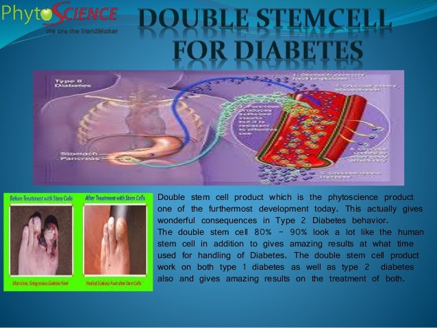 stem cell treatment for diabetes type 2 cost