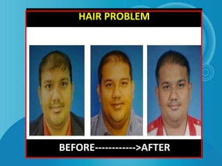 BEFORE------------>AFTER
HAIR PROBLEM
 
