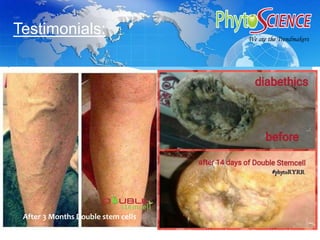 Procedure:
After 3 Months Double stem cells
We are the TrendmakerWe are the Trendmakers
Testimonials:
 